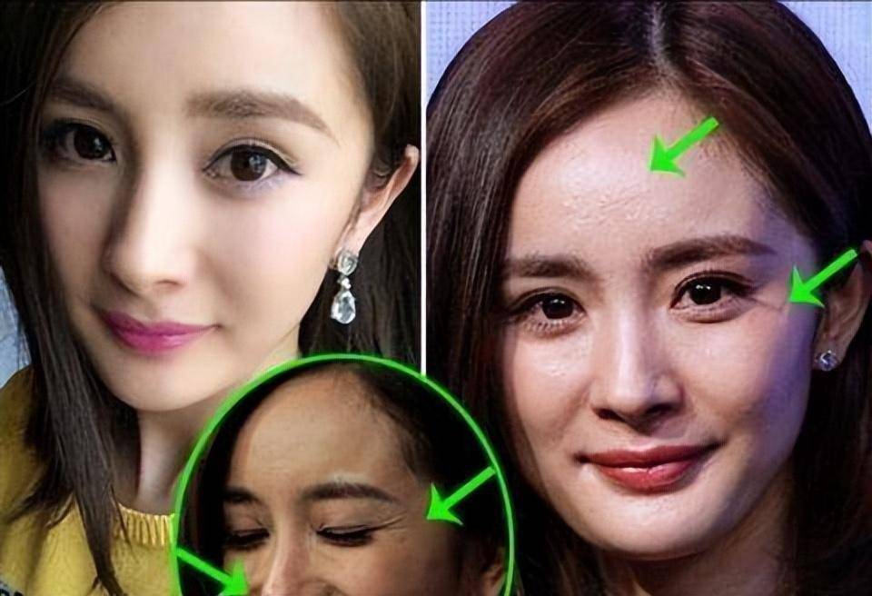 其它部位倒还好,只不过眼睛大的人眼周松弛得也早,所以杨幂的眼部皱纹