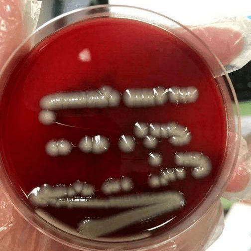 "刀枪不入"的危险细菌——鲍曼不动杆菌_培养基_消毒剂_能力