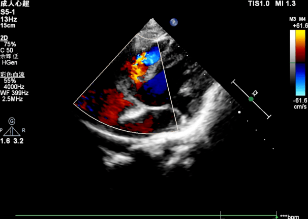 华南首例|张智伟教授,汪周平教授于广州妇女儿童医疗中