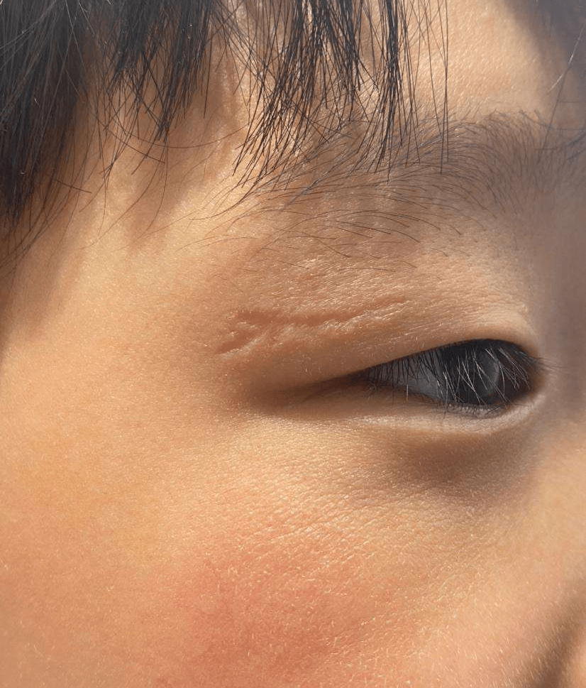 有句老话说,眼睛周围有疤的人命好,你们信么?_宫有_感情_子女