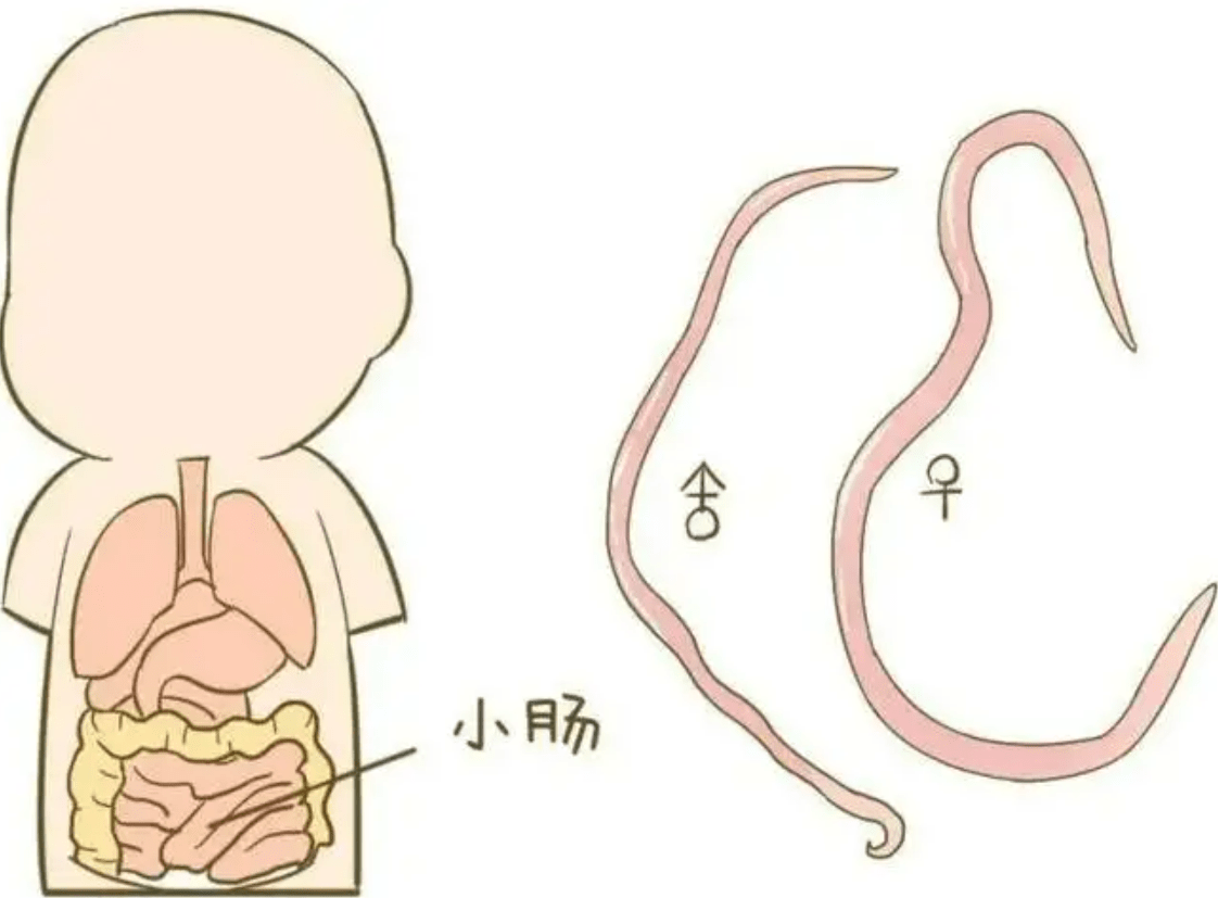 在几十年前,几乎人人肚子里都有蛔虫,为何现在很少听说过了?