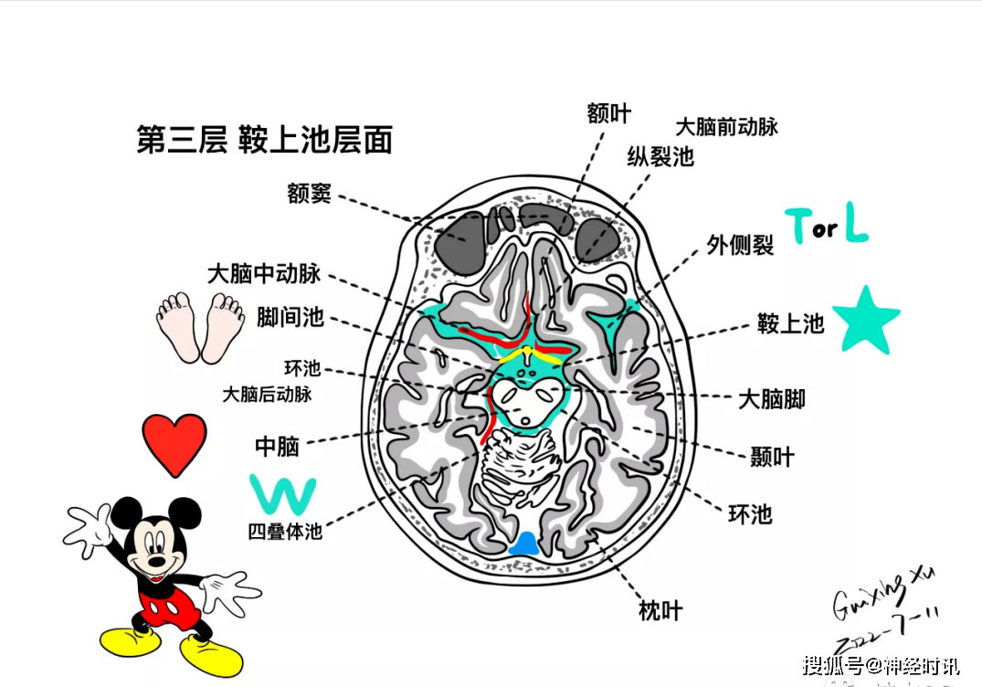 大脑半球结构图解剖图图片