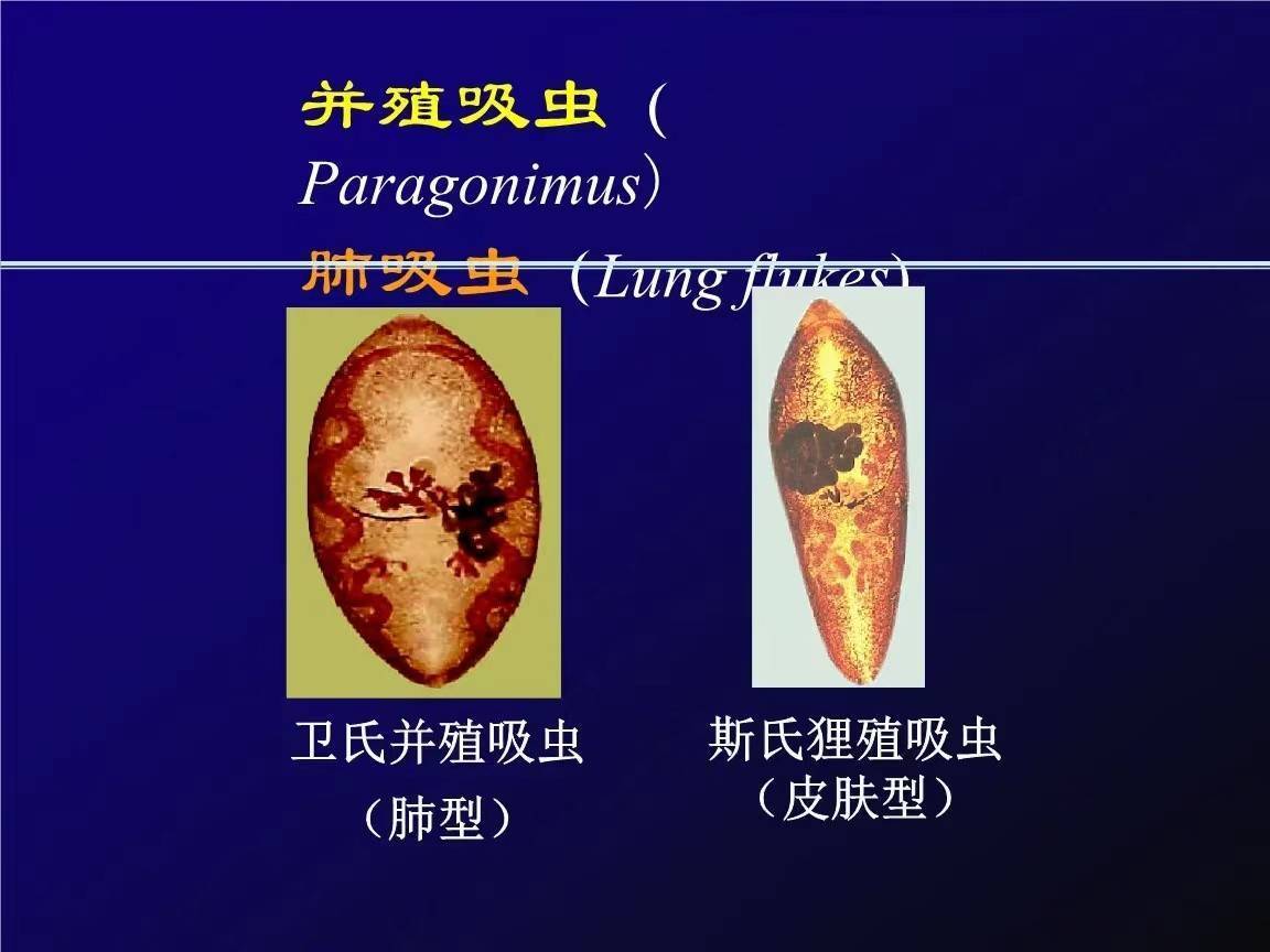 小伙报复螃蟹感染肺吸虫病,游走在你器官上的寄生虫有多可怕?