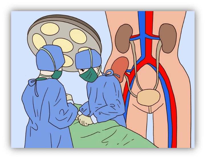 仁济科普 | 肾移植超声:为"肾"命"移"路保驾护航