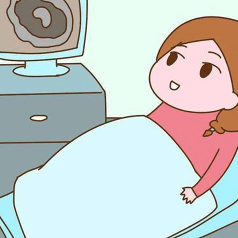 一个月孕囊b超图片图片