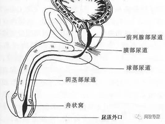 间歇导尿时插管困难的应对技巧