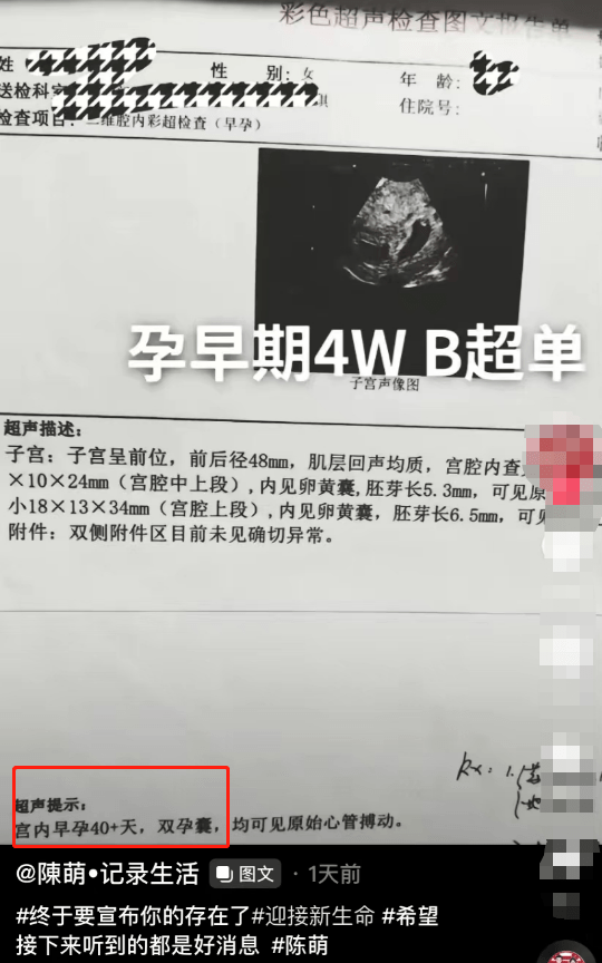 陈萌大婚被指寒酸