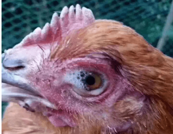 鸡眼睛 常见病图片