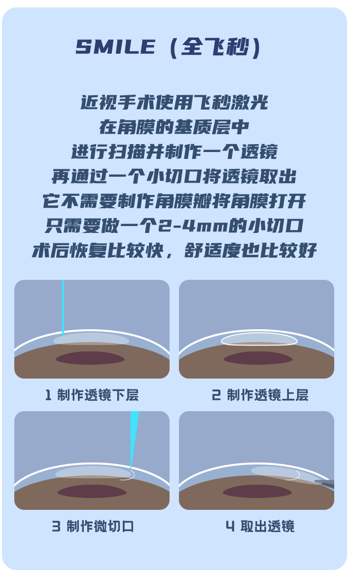 近视手术,可以改善眼球外凸的问题吗?