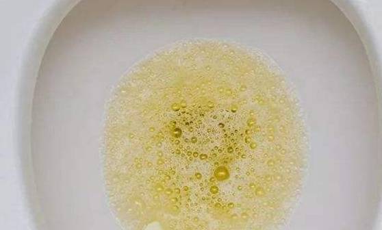 尿液_时候_颜色