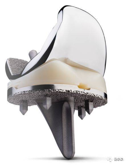 捷迈邦美3d打印胫骨获得fda许可_persona_公司_膝关节