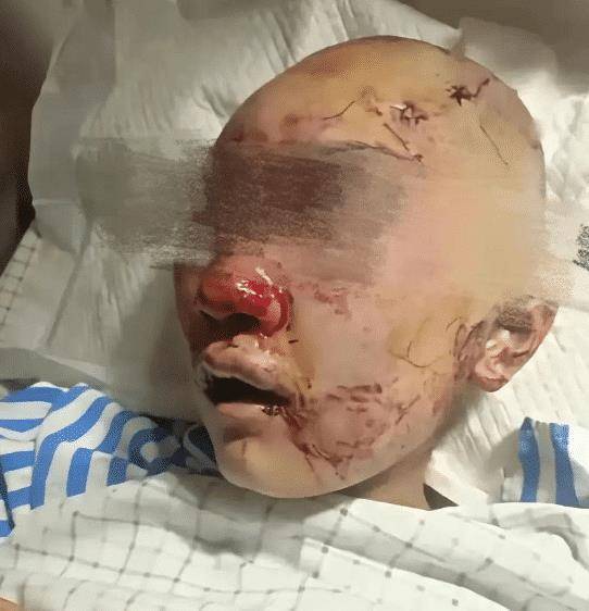 浙江一女子在公厕被19岁男子殴打20分钟,遭砖头砸满脸是伤,致轻伤二级