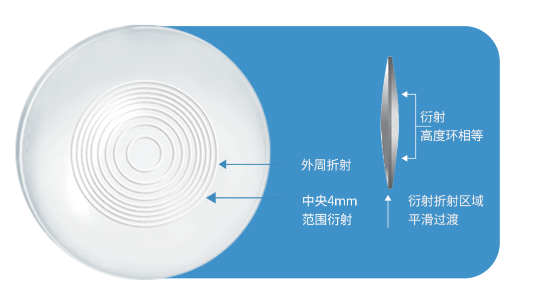 新品 | 普诺明全视非球面衍射型多焦人工晶状体获批上市
