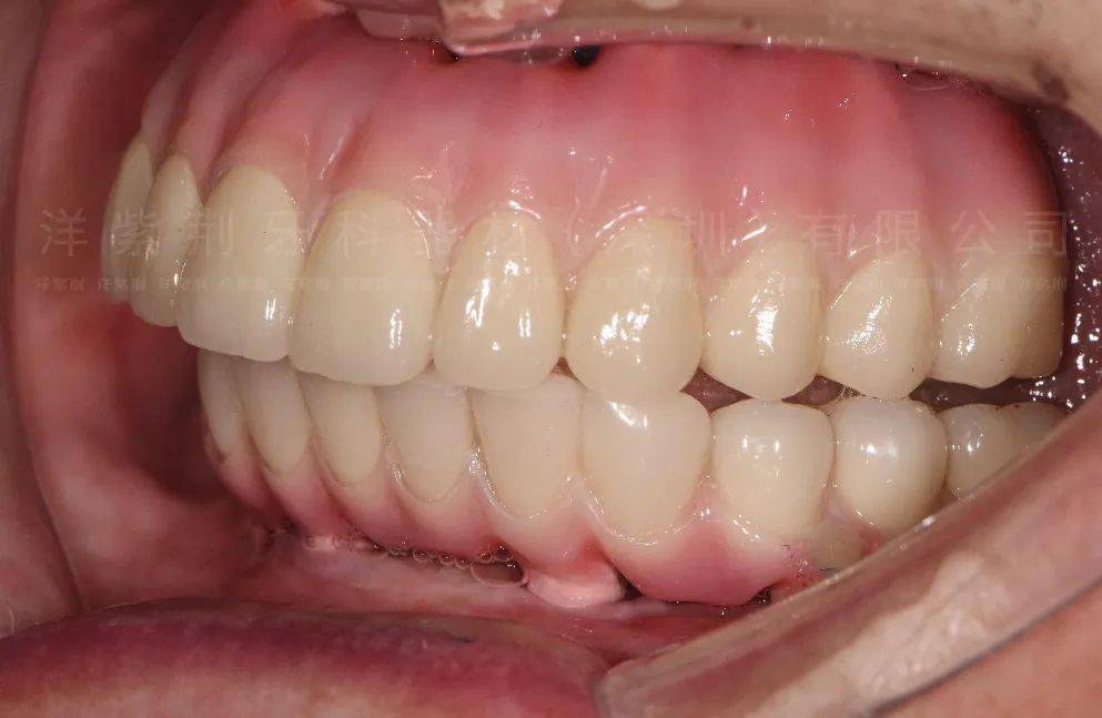 定期复查洋紫荆,是国内知名的牙科技工中心,成立于1998年.