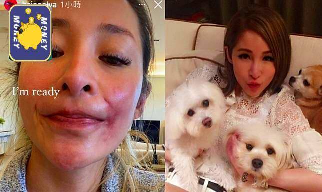 萧亚轩遭爱犬咬伤5个月曝疤痕等不到回归舞台照镜子都想哭_样子_周刊