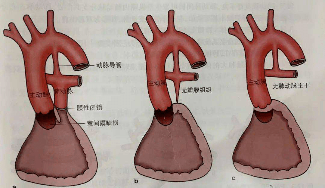 第二十五期 胎儿医学多学科会诊