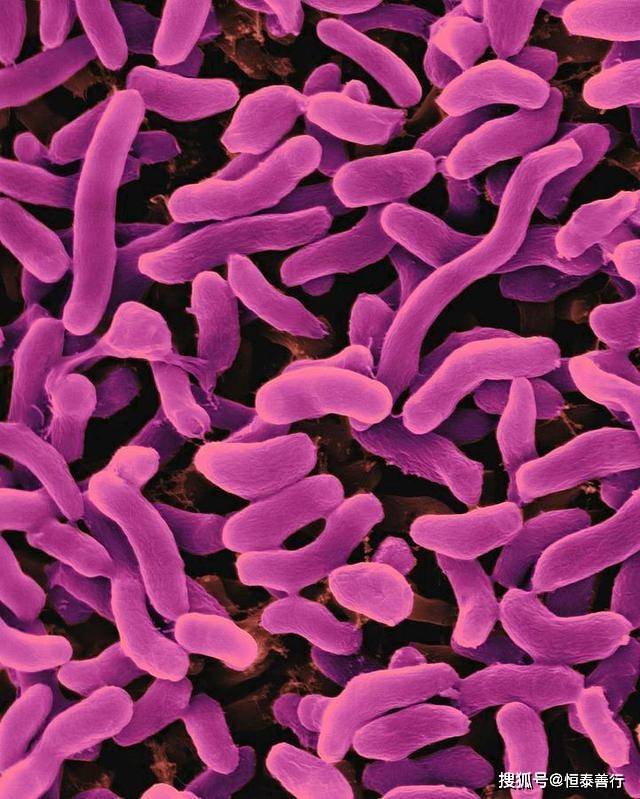 肠杆菌科多样化菌属——bilophila(嗜胆菌属)_肠道_炎症_饮食