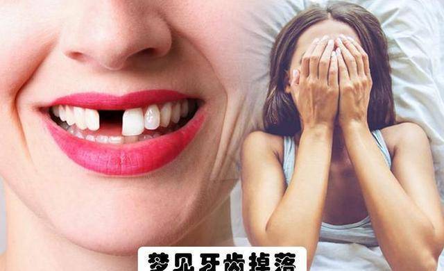 梦见上面大牙掉了一颗，梦境背后的深层含义与解析