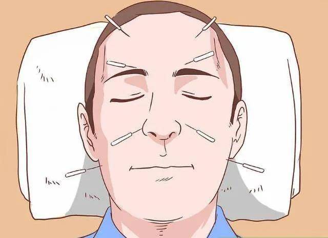 寒风吹啊吹,小心"面瘫"_面部_治疗_原因