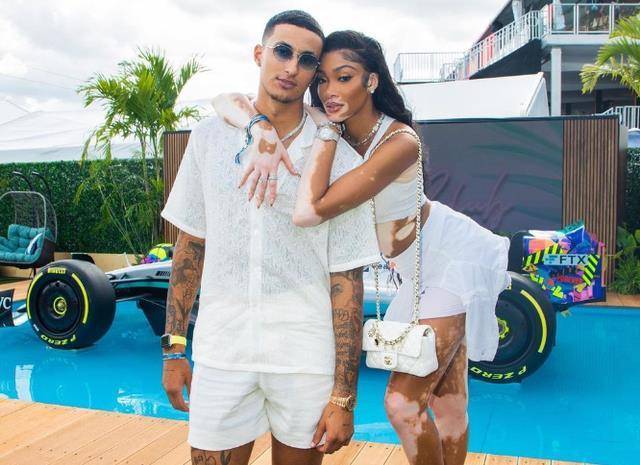 库兹马女友走红毯,穿透视装展现好身材,大片白斑惹人嫌!