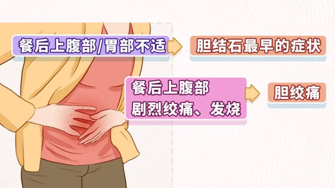 剧烈的上腹部绞痛,发烧,甚至出现了不可忍受的剧痛,医学上叫胆绞痛,这