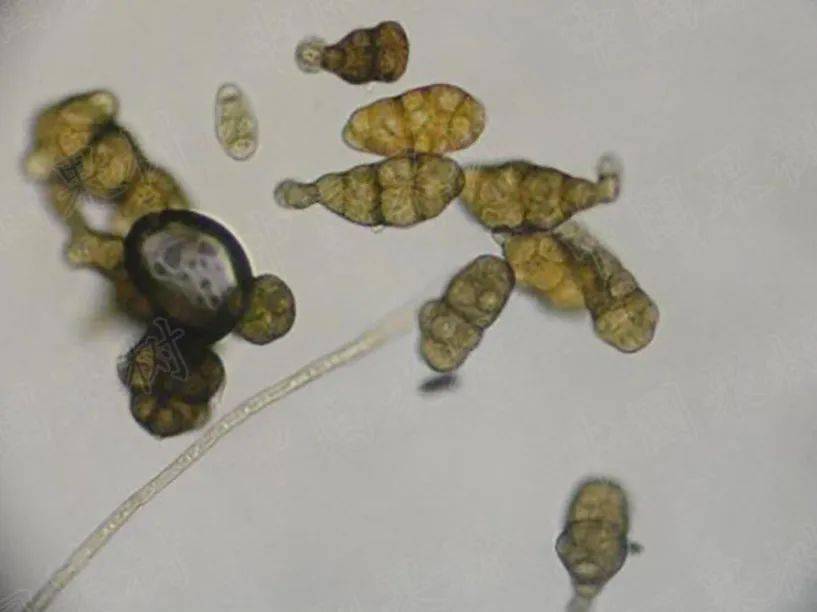 黑斑病菌落及孢子形态特征病原菌为链格孢,属于半知菌亚门丝孢纲丝梗