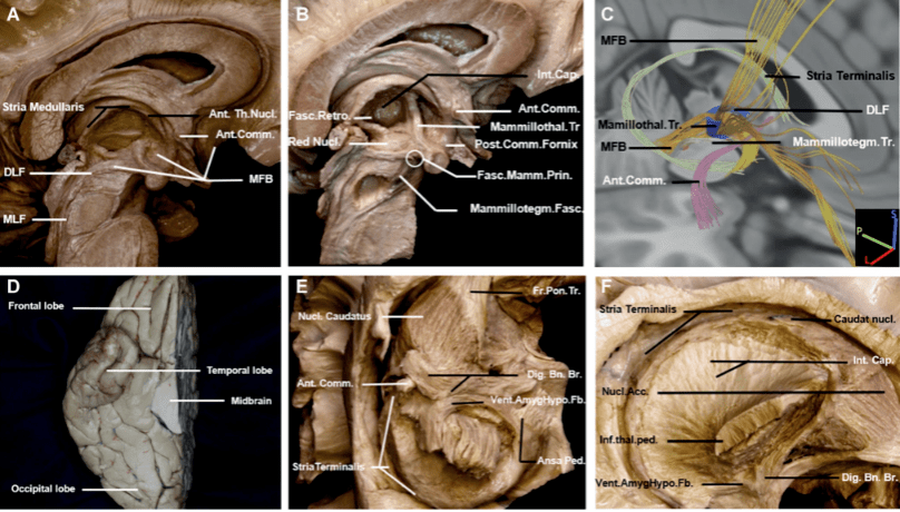 【精选编译】下丘脑显微结构和白质纤维解剖_乳头_成像_broca