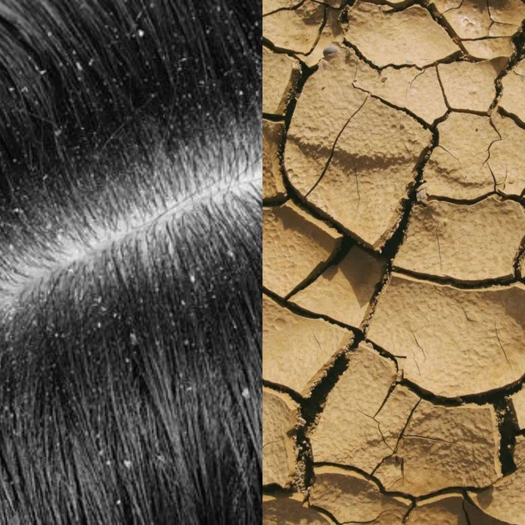 洗了一辈子头发,你洗过头皮吗?_海盐_洗发膏_生物