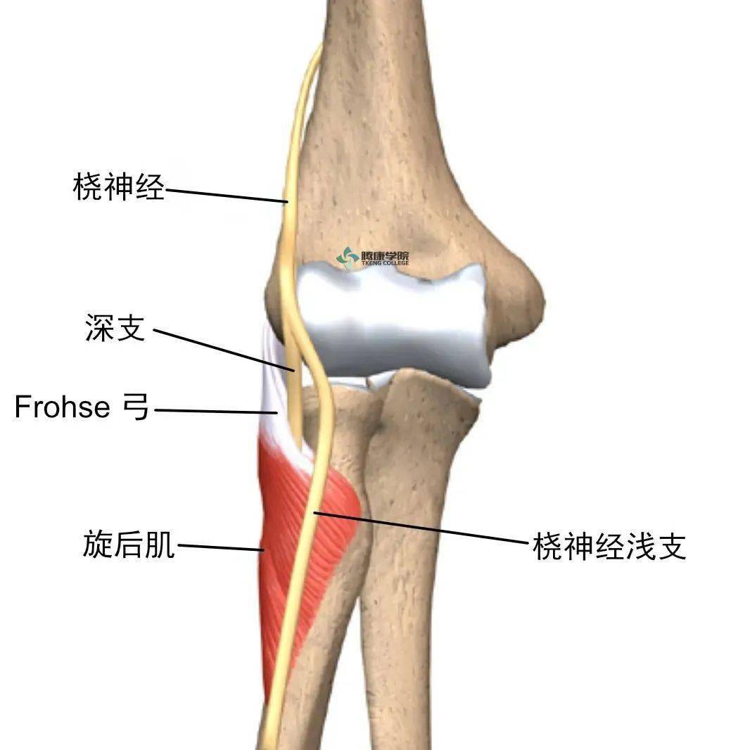 frohse弓图片