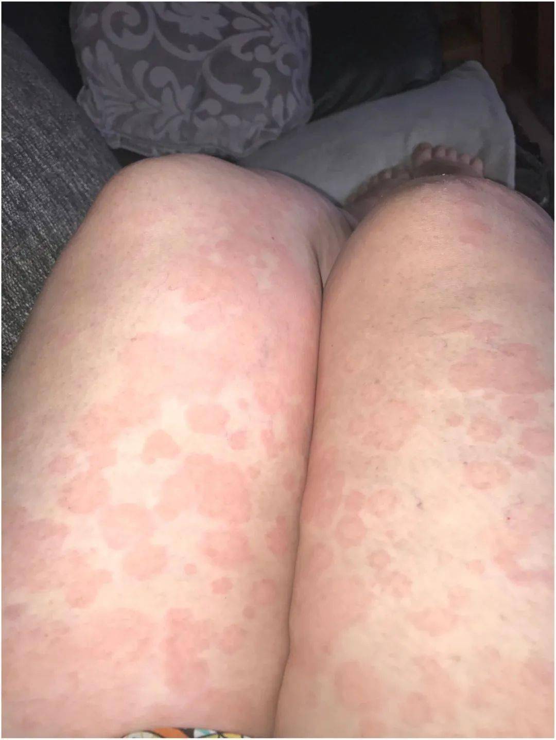  疫情啥症状?(中国三年疫情死亡人数)