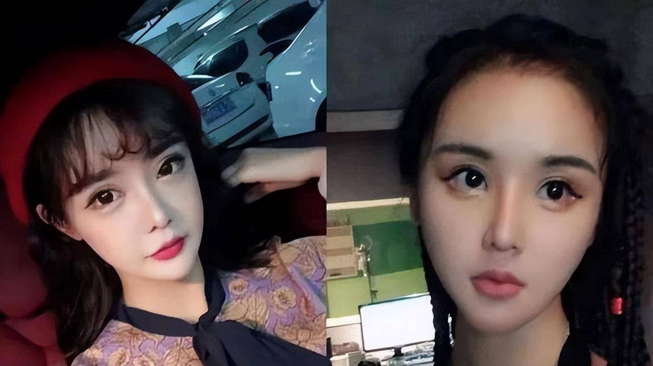 《变形记》之后,李幼恩也开始整容了,状态不输韩安冉_漂亮_后遗症