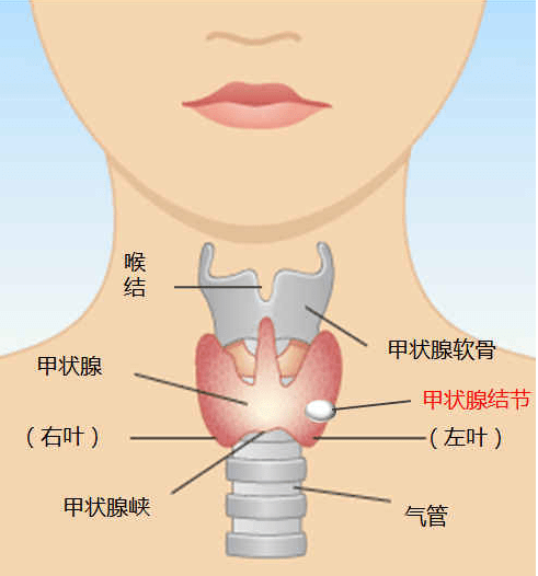 甲状腺分左右两叶,位于甲状软骨下方气管两旁,中间以峡部连接