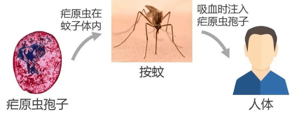 疟疾的拼音图片