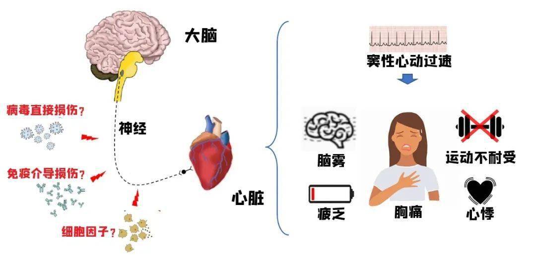 或者通过引发人体产生自身抗体影响神经调节功能,最终使副交感神经