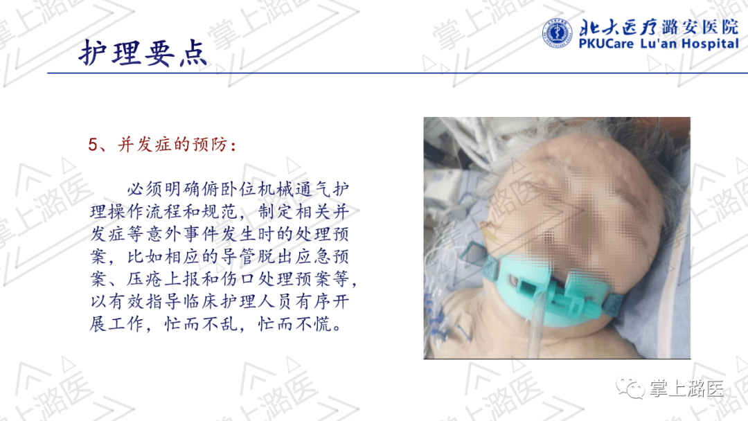 【ppt】俯卧位通气的护理