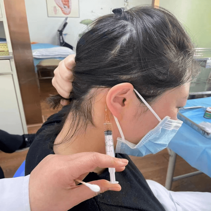 图:声治疗(左),耳迷根穴位注射(右)04鼻出血病发机制:新冠感染后由于