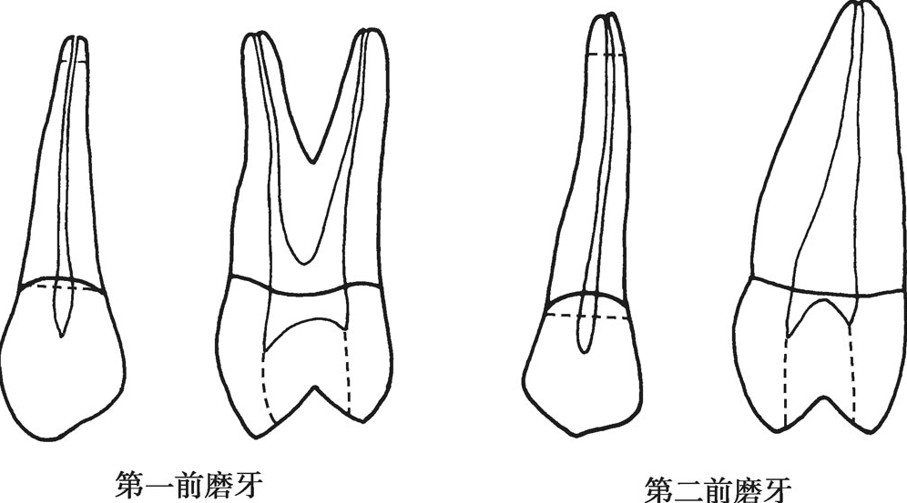 根管系統形態解剖及圖解,詳解._遠中_上頜_下頜