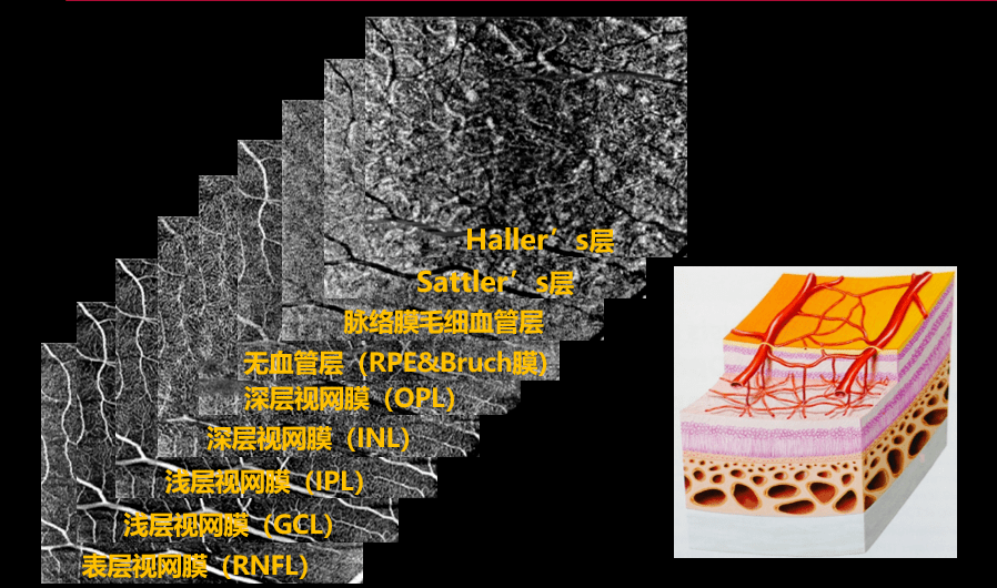 眼科oct检查报告怎么看图片