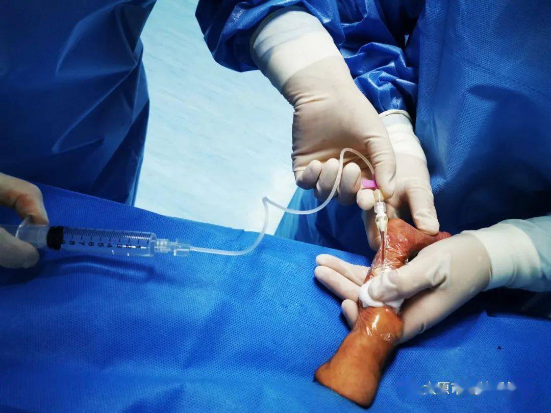 关注| 市妇幼新生儿picc置管术 打通"巴掌宝宝"生命线_静脉_患儿_难度