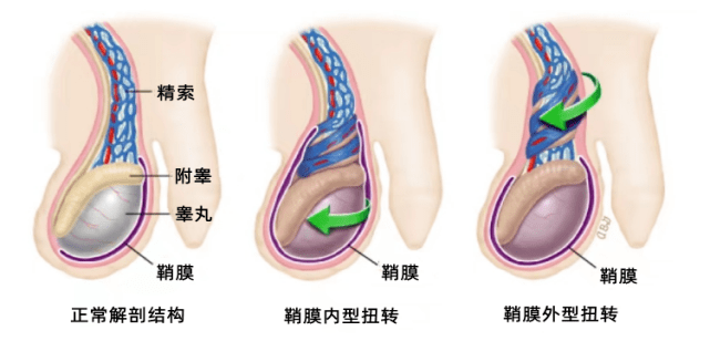 8岁儿童睾丸13×8 小孩图片