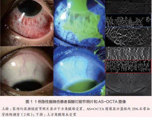 眼科oct报告单图片