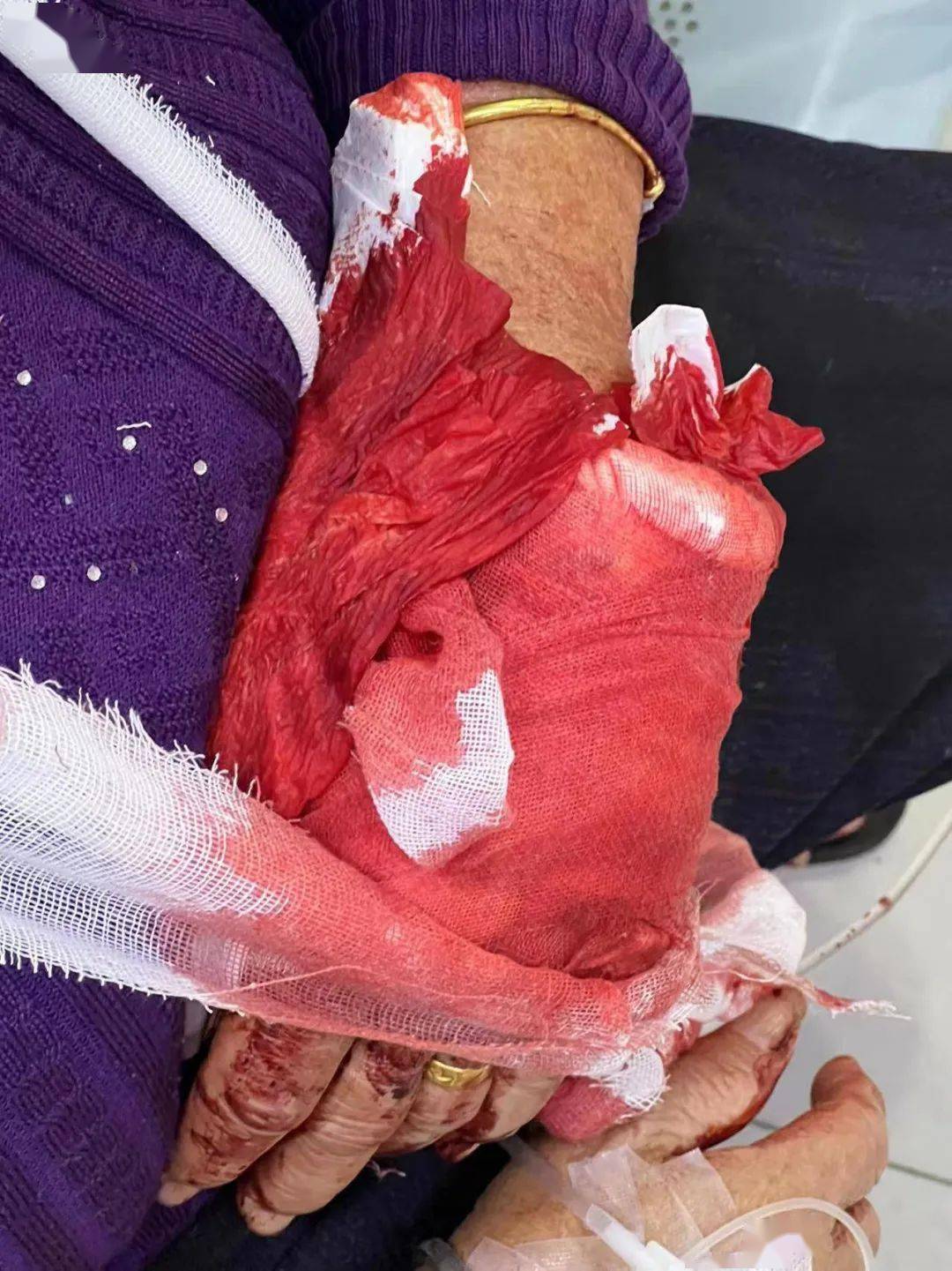 事件,一名男子闯入民宅砍伤两老夫妻