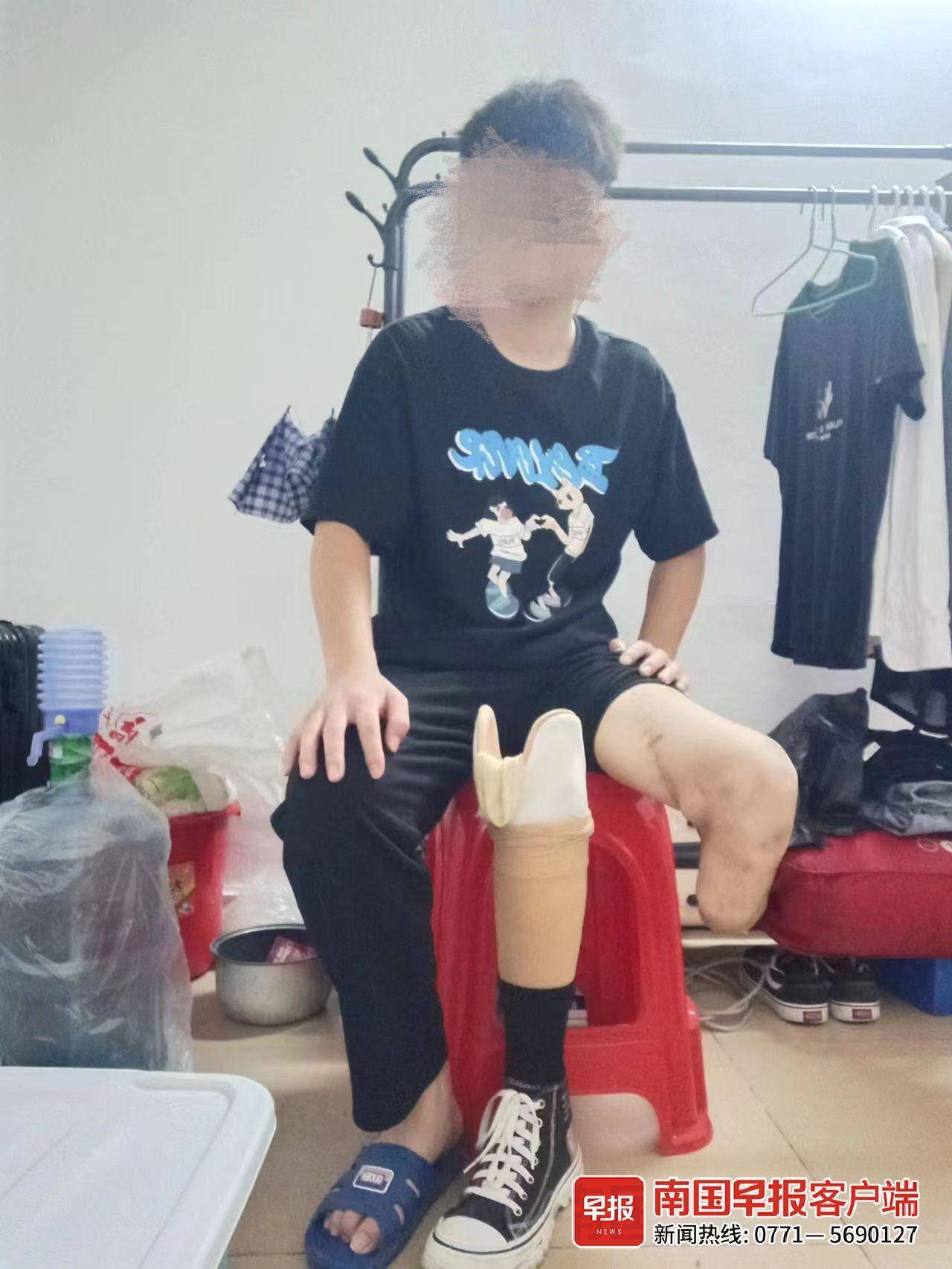 医院未及时对症治疗,宾阳17岁少年车祸后被截肢_过错_诊疗_右小腿