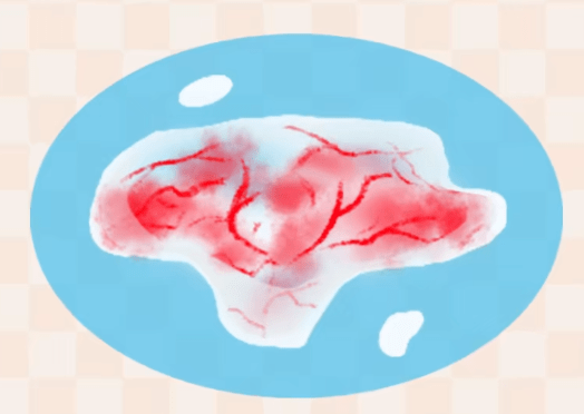 咳痰有这个情况,一定得去医院!尤其是孩子!_宝宝_问题_家长