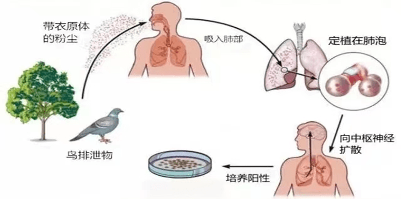 人感染鹦鹉热衣原体主要通过呼吸道途径:鹦鹉热的传播途径鹦鹉热的