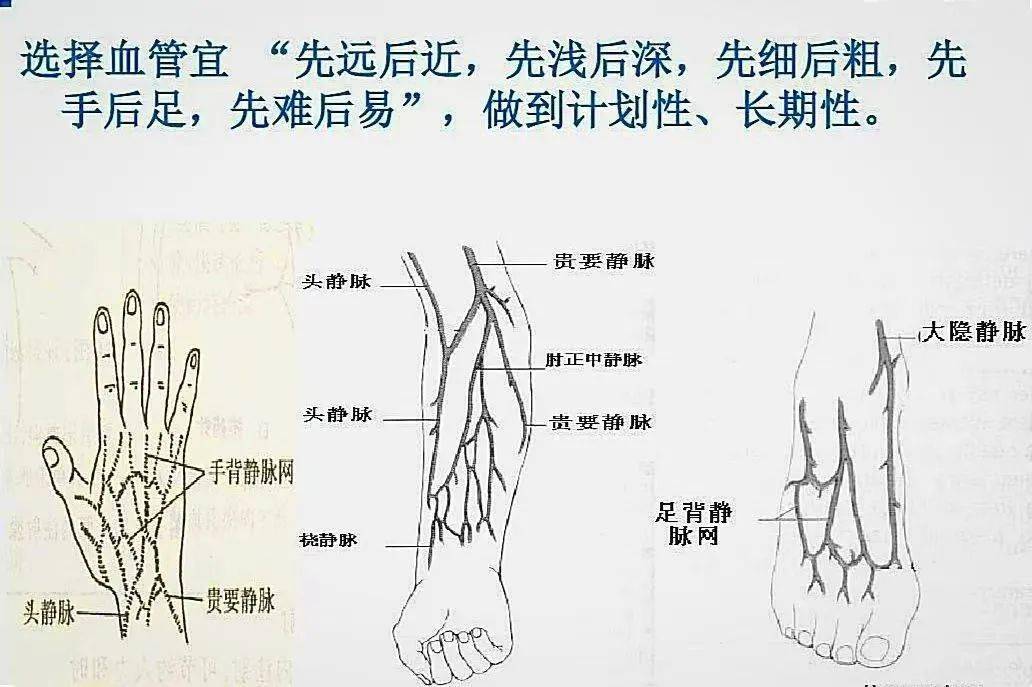 肘部静脉血管分布图图片