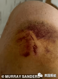 Ӣ˾����Ů�߹ټұ��ɷ�20�꣡ȭ����߾�ƿ�ң��з����� ...