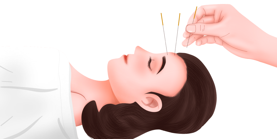 面瘫不分年龄!95后也遭殃!这些原因都会引起病发,中医食疗有对策!