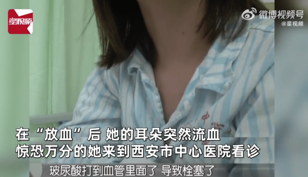 空姐注射玻尿酸打进血管差点丧命:头扎200多针被“放血”(图6)