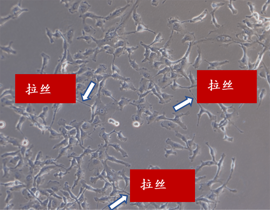 ht1080 (人纖維肉瘤細胞)被支原體